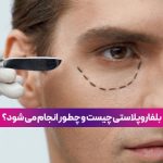 بلفاروپلاستی چیست، چگونه انجام می‌شود و چقدر هزینه دارد؟